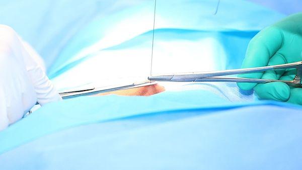 O karpálních tunelech s MUDr. Jiřím Jurčou