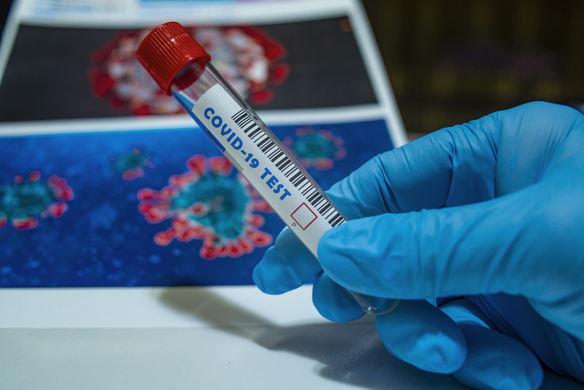 PCR Test (Covid 19)