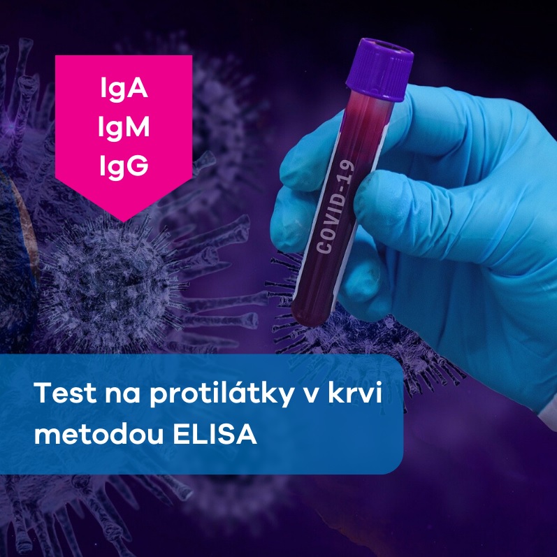 ELISA test (Covid 19)