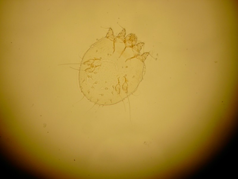 Svrab – přenos, léčba a prevence