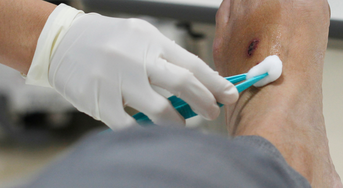 Otevřeli jsme Centrum hojení chronických ran