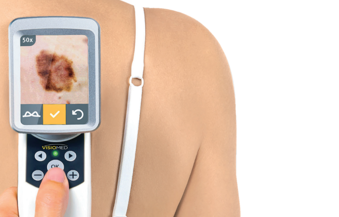 Evropský Den melanomu 2025