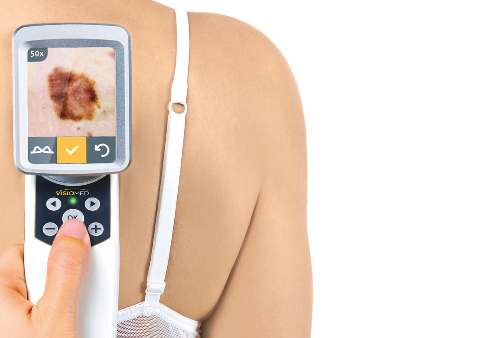 Zachyťte problémy včas a přijďte za námi na DNY MELANOMU!